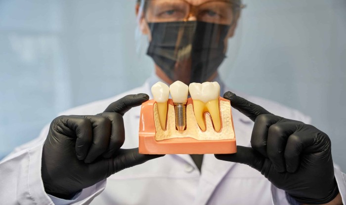 Male dentist holding a dental implant model in front of the camera