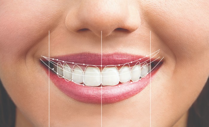 Close-up of a woman’s smile with digital design lines mapped over her teeth.