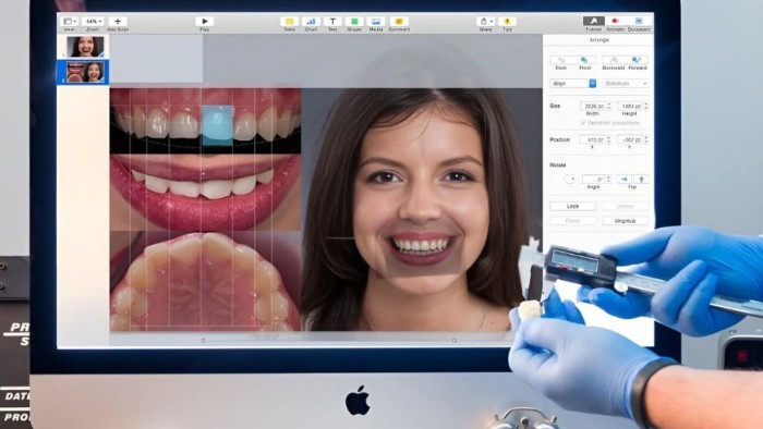 A computer monitor displaying Digital Smile Design software.
