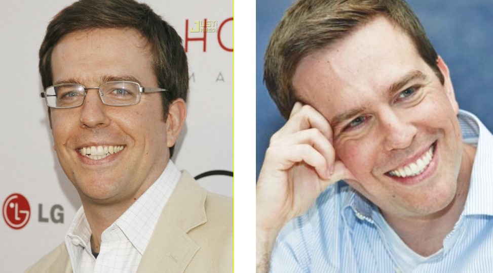 Ed Helms before and after implants