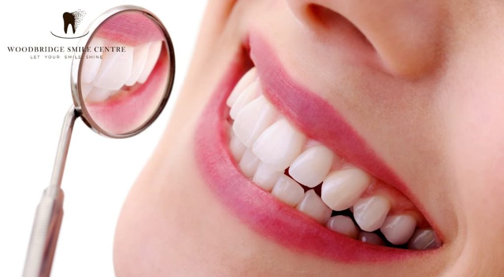 Benefits of Teeth Whitening