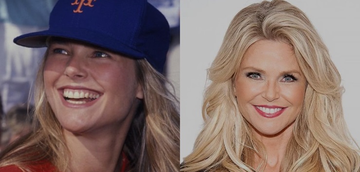 Christie Brinkley dental implants