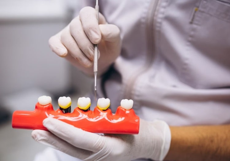 a dentist with dental crowns