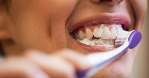 Teeth Cleaning Tips for a Healthier, Brighter Smile