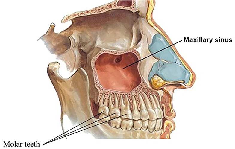 toothache vs. sinus pain