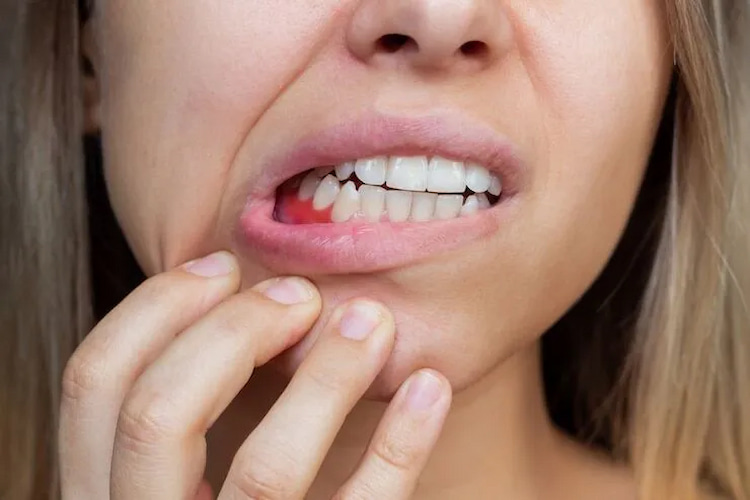 a photo of bleeding swollen gums signs and symptoms