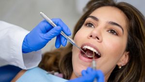 dental examination for craze line detection